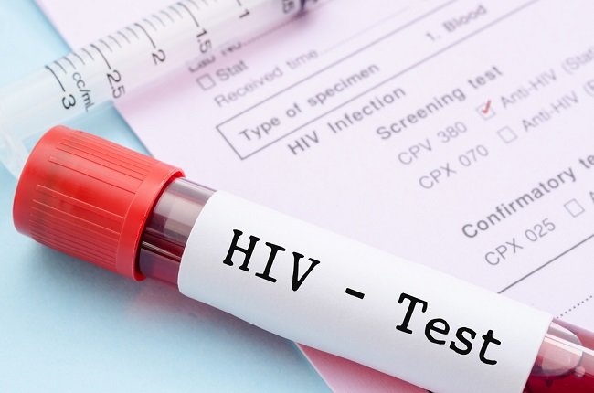 kpa-jabar-29-kasus-baru-hivaids-per-hari