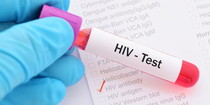 kasus-hivaids-di-cianjur-terus-meningkat-mayoritas-lsl